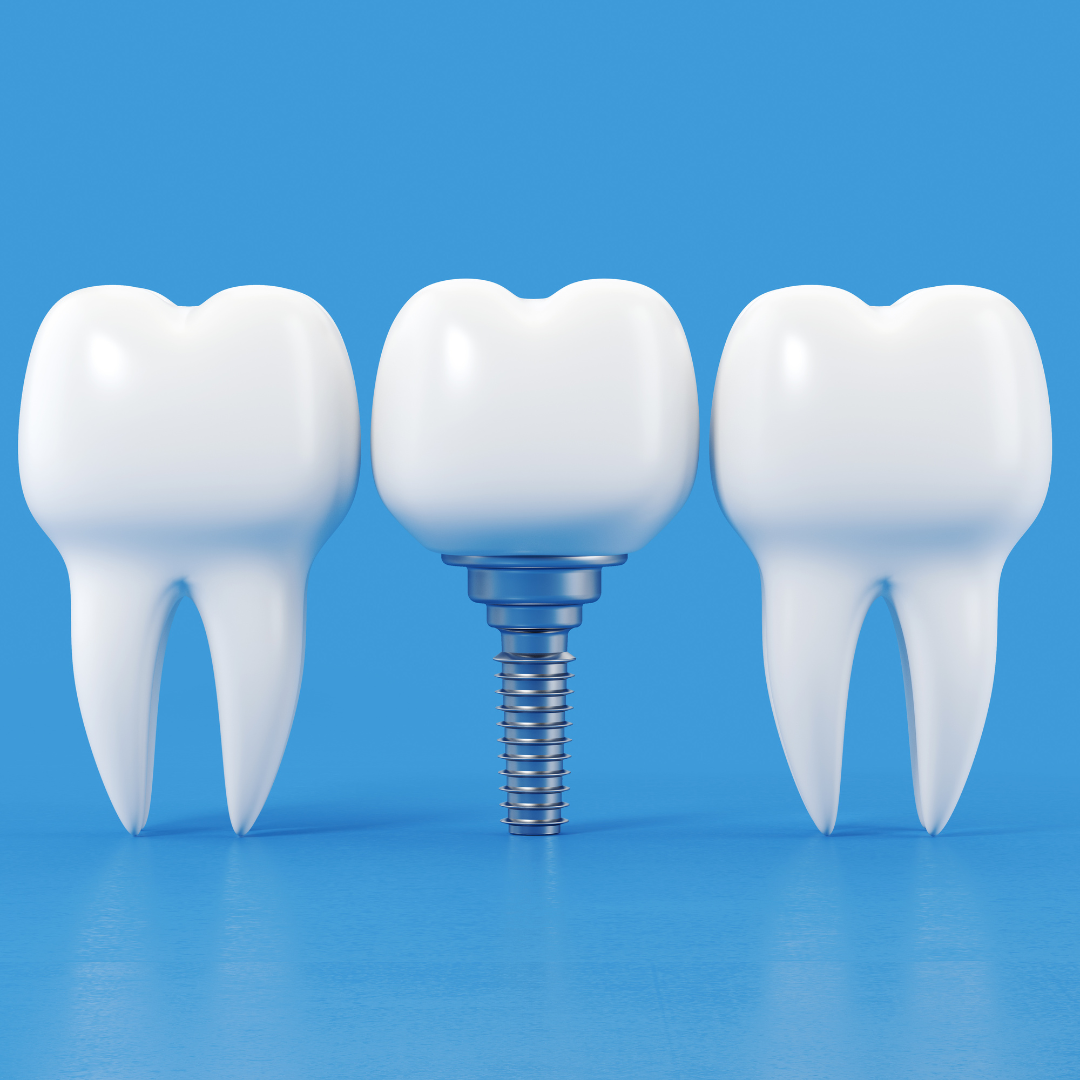 Clínica Dental en Madrid